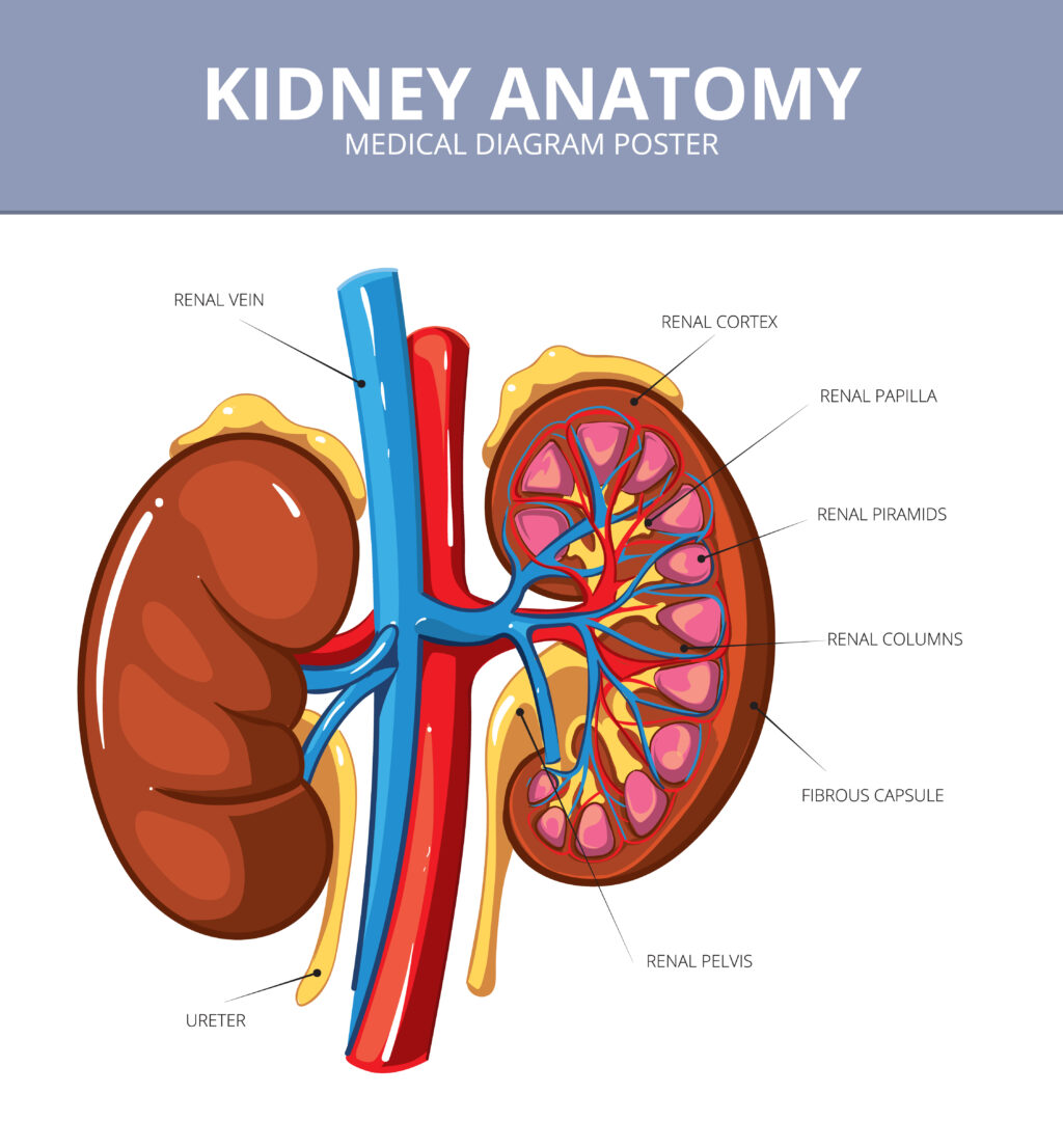 Kidney Stone