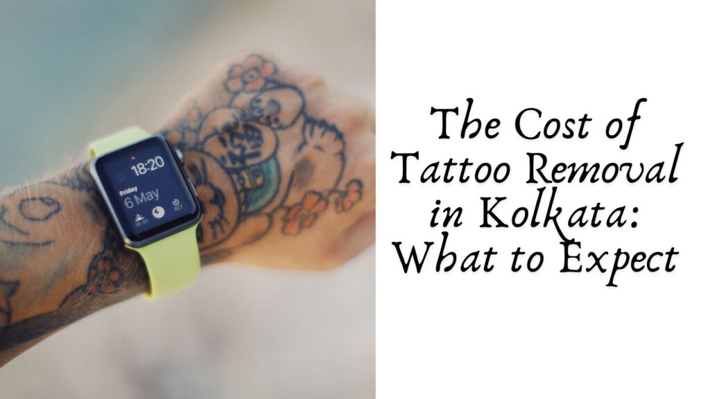 The Cost of Tattoo Removal in Kolkata: What to Expect