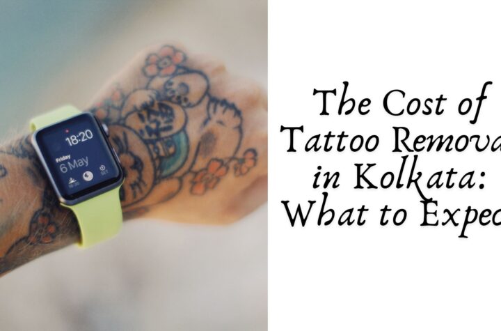 The Cost of Tattoo Removal in Kolkata: What to Expect