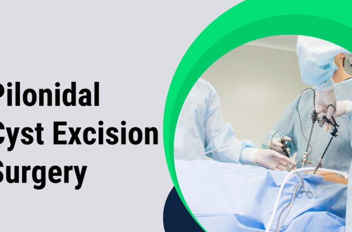 pilonidal cyst excision surgery