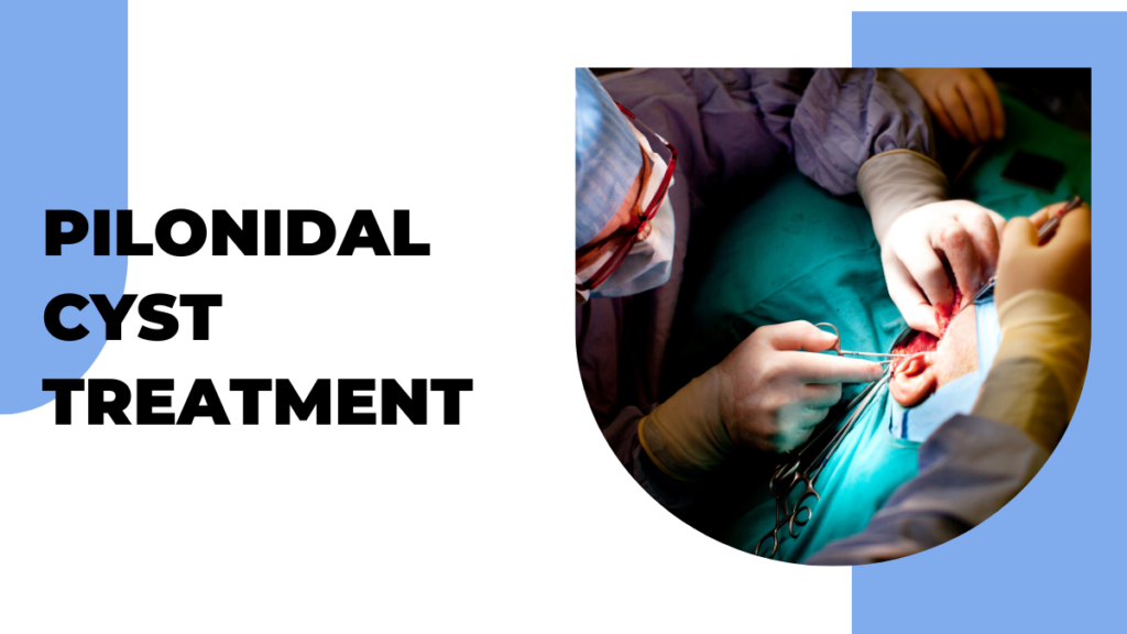 pilonidal cyst treatment