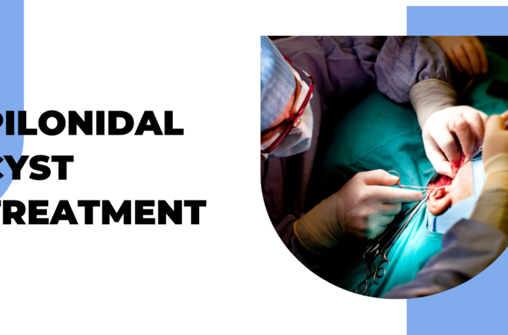 pilonidal cyst treatment