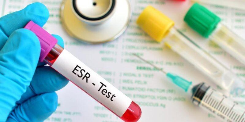 ESR Test