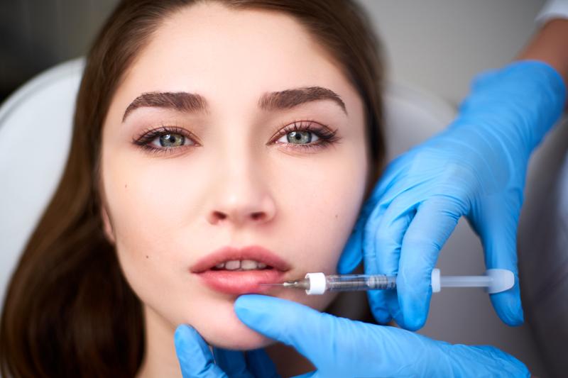 Russian Lip Fillers in Dubai